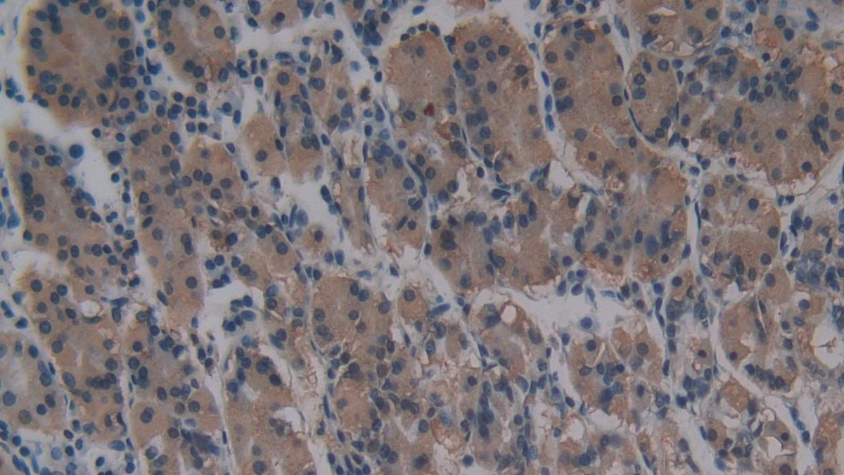 Monoclonal Antibody to Cross Linked N-Telopeptide Of Type I Collagen (NTXI)