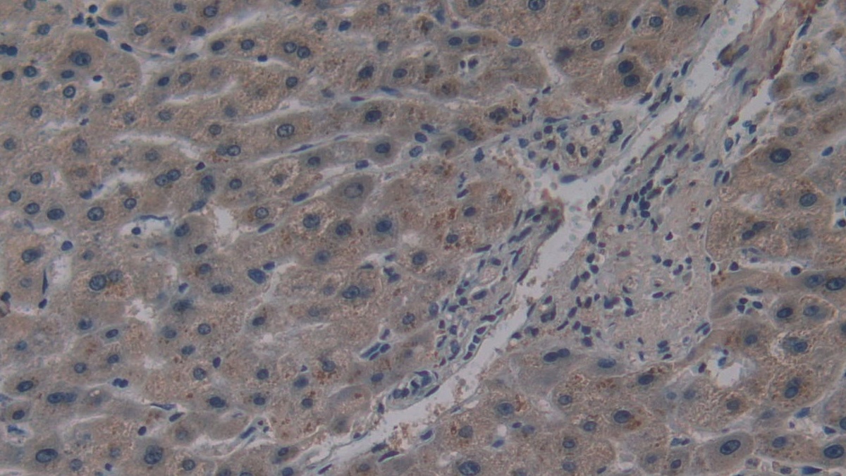 Monoclonal Antibody to Cross Linked N-Telopeptide Of Type I Collagen (NTXI)