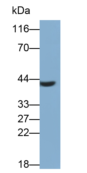 Monoclonal Antibody to Receptor For Advanced Glycation Endproducts (RAGE)