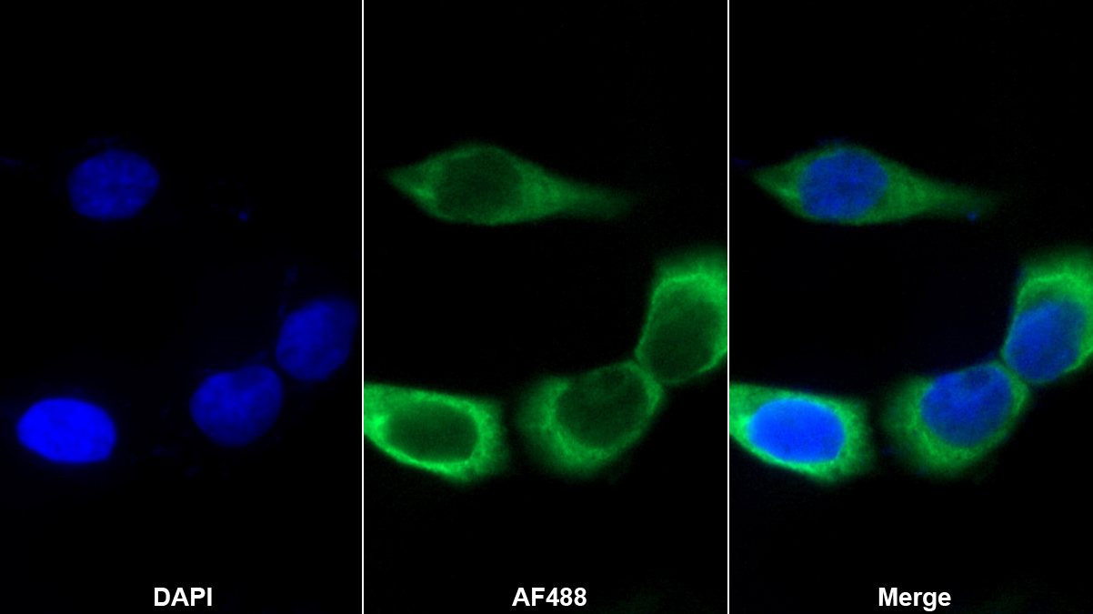 Monoclonal Antibody to Interleukin 7 (IL7)