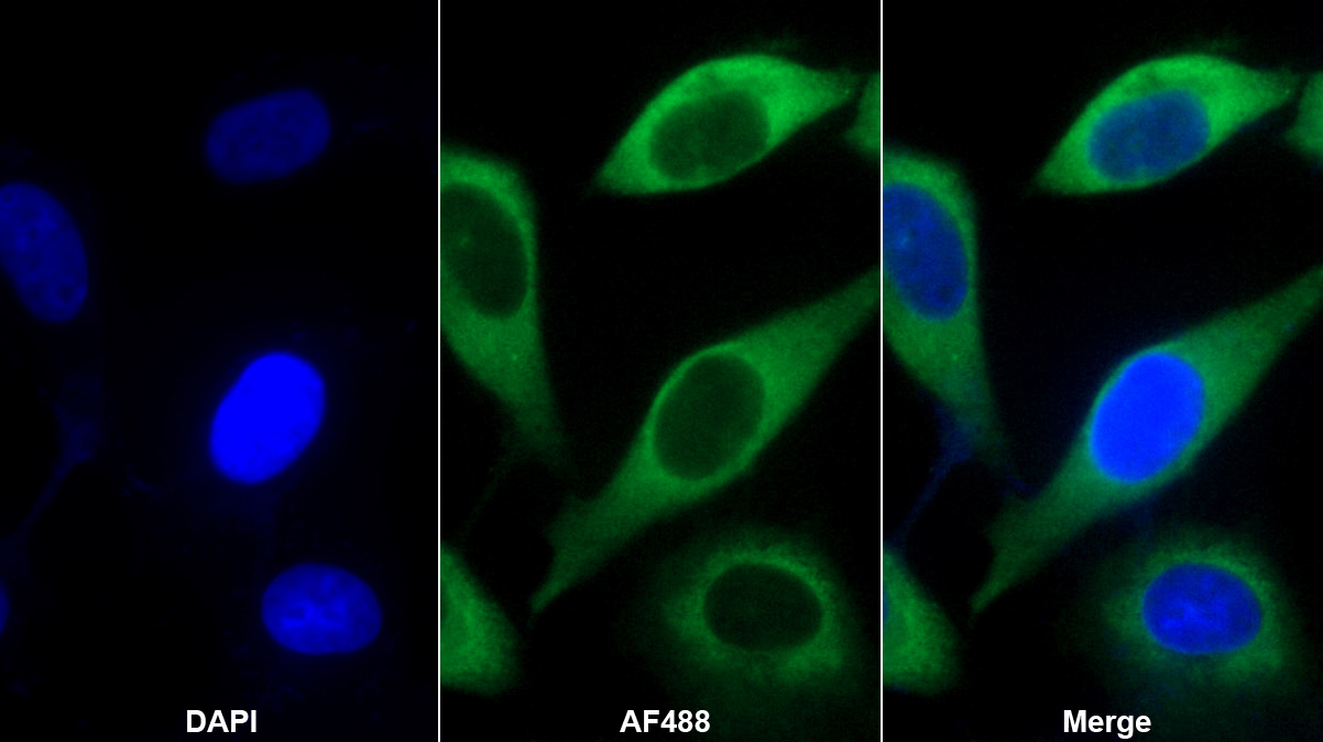 Monoclonal Antibody to Interleukin 7 (IL7)