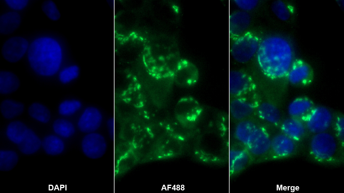 Monoclonal Antibody to Mucin 5 Subtype B (MUC5B)