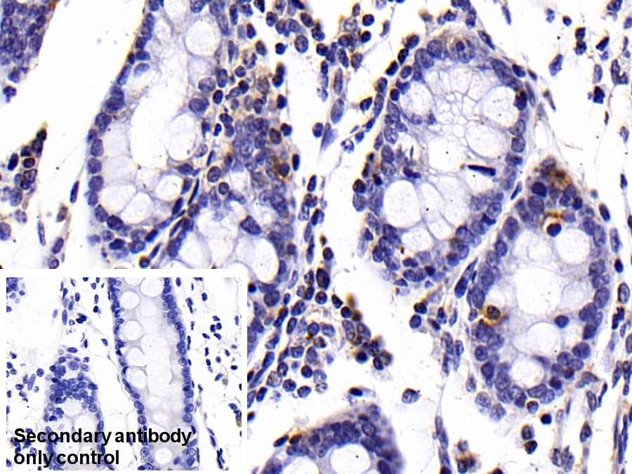 Monoclonal Antibody to Cluster Of Differentiation 14 (CD14)