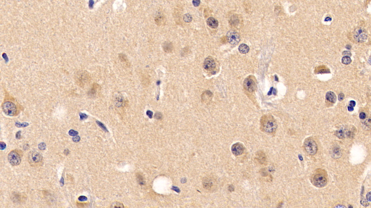 Monoclonal Antibody to Neuropilin 1 (NRP1)