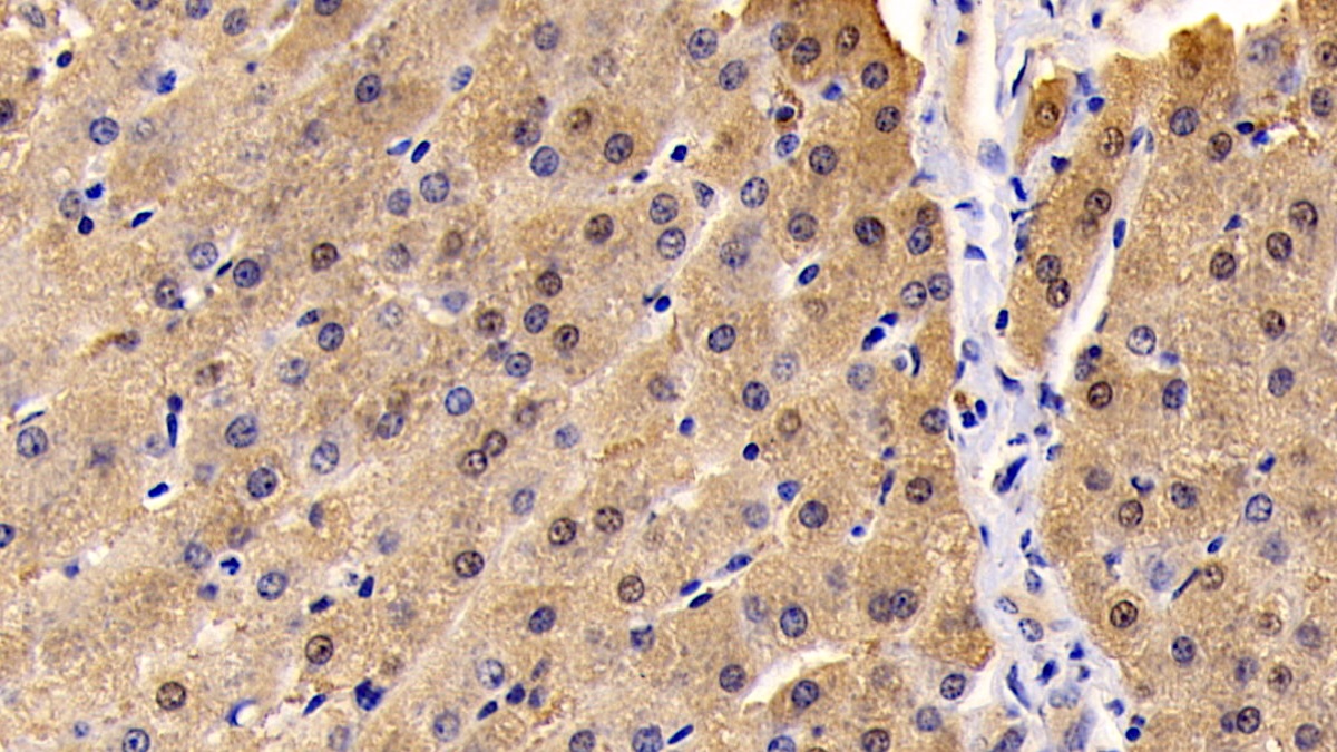Monoclonal Antibody to Neuropilin 1 (NRP1)