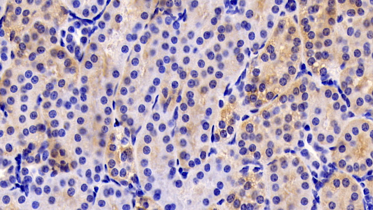 Monoclonal Antibody to Neuropilin 1 (NRP1)