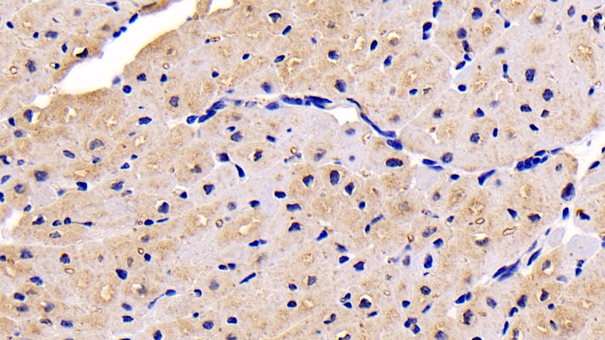 Monoclonal Antibody to Neuropilin 1 (NRP1)