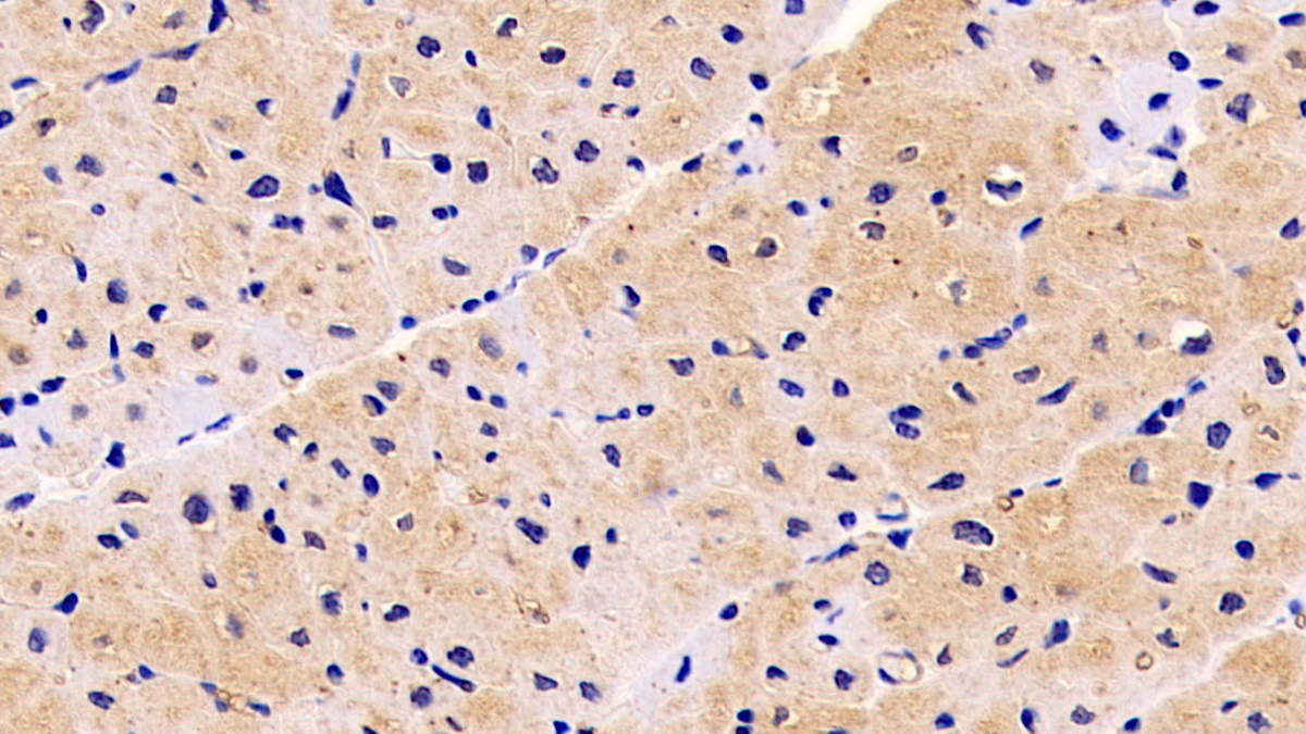 Monoclonal Antibody to Neuropilin 1 (NRP1)