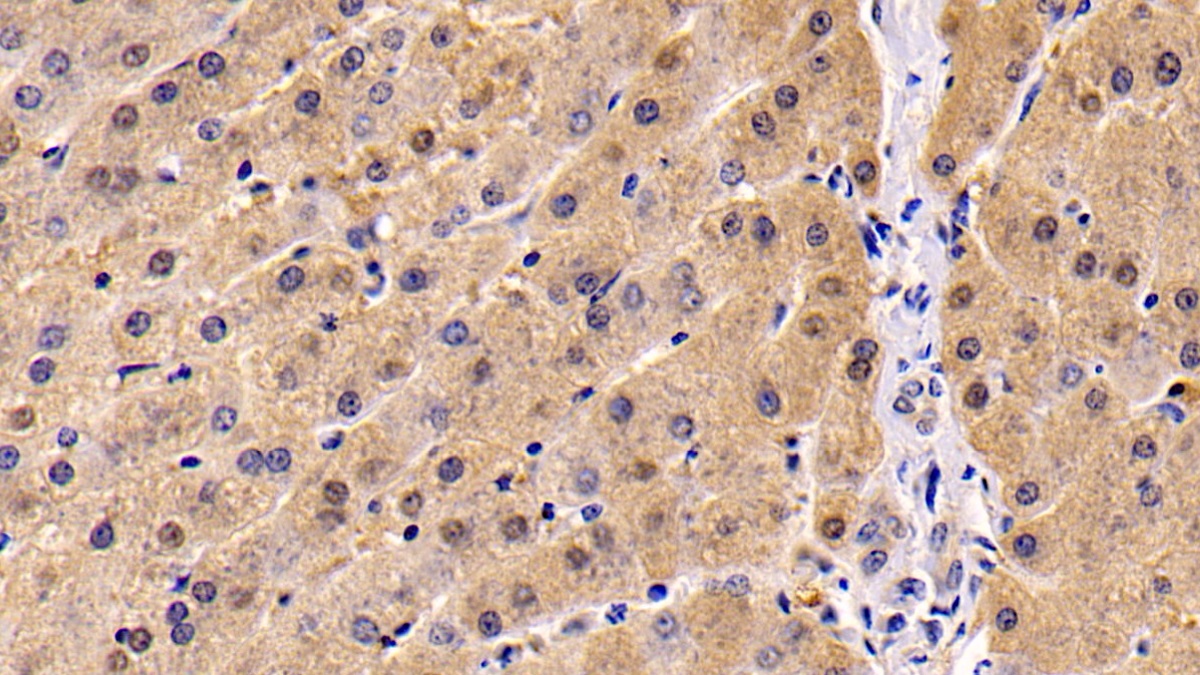 Monoclonal Antibody to Neuropilin 1 (NRP1)