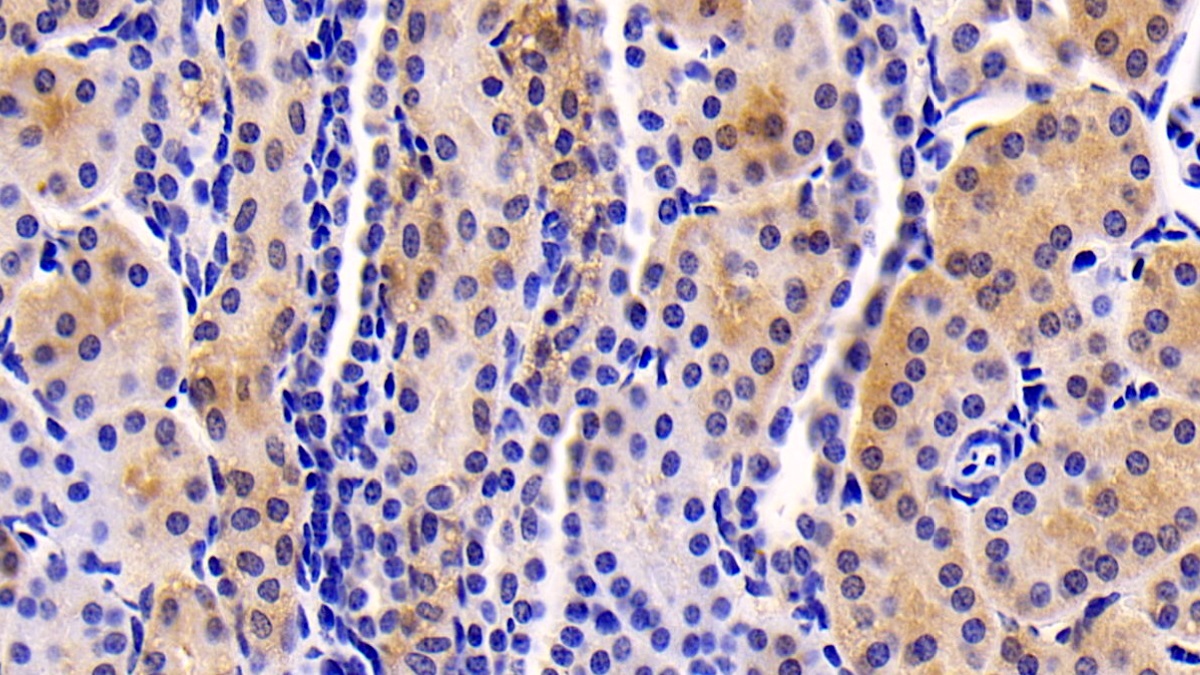 Monoclonal Antibody to Neuropilin 1 (NRP1)