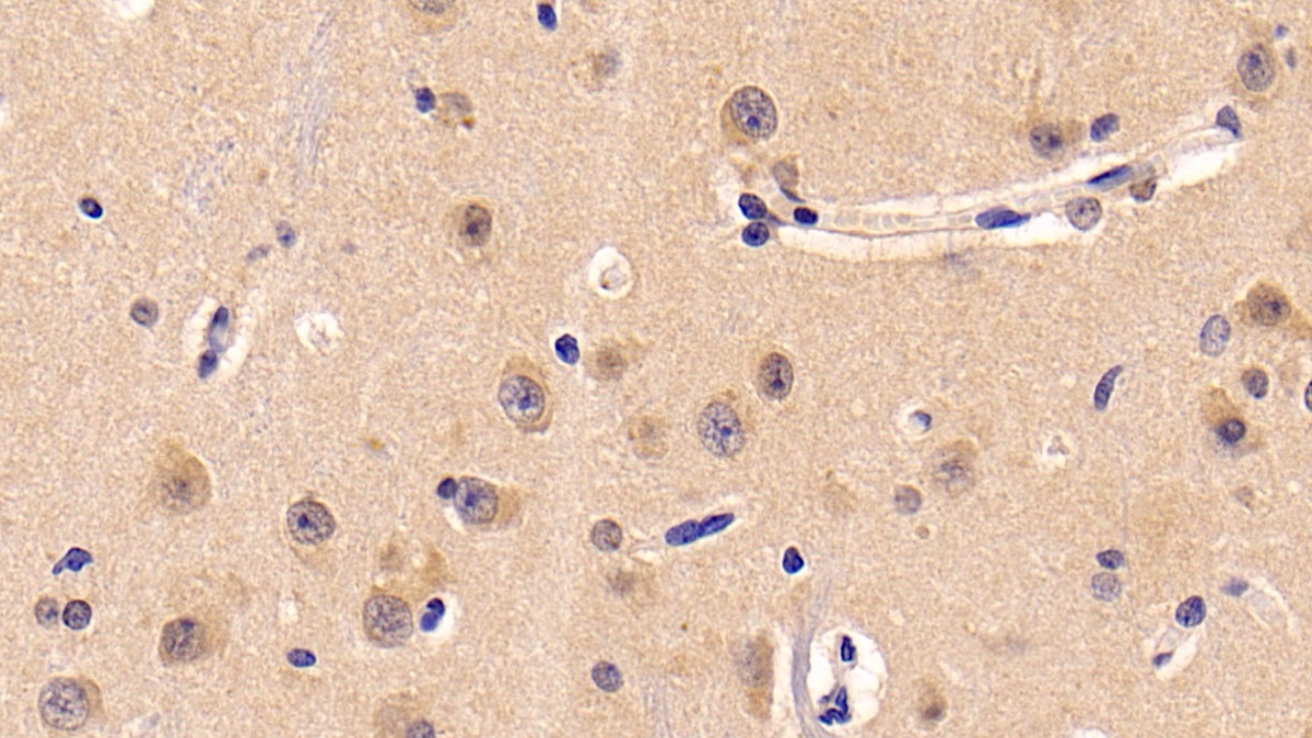 Monoclonal Antibody to Neuropilin 1 (NRP1)