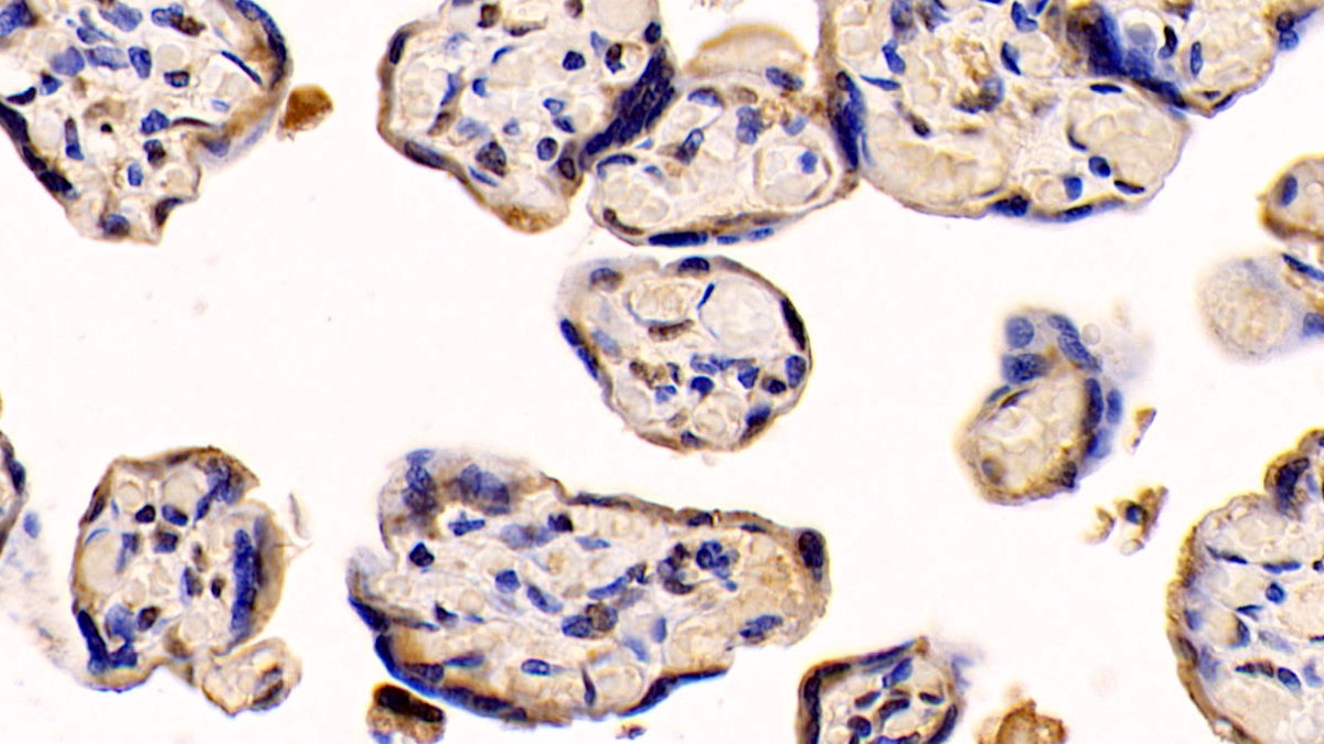 Monoclonal Antibody to Neuropilin 1 (NRP1)