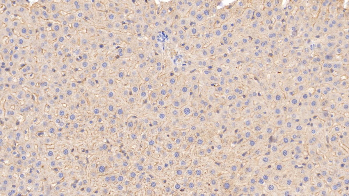 Monoclonal Antibody to Apolipoprotein E (APOE)