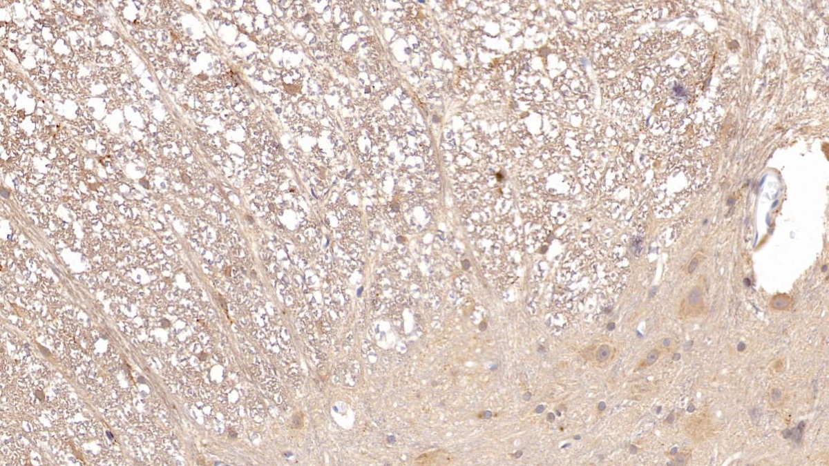 Monoclonal Antibody to Apolipoprotein E (APOE)