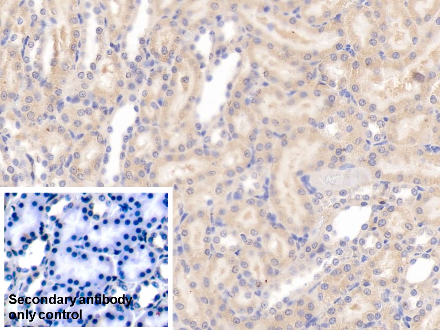 Monoclonal Antibody to Apolipoprotein E (APOE)