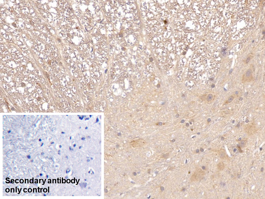 Monoclonal Antibody to Apolipoprotein E (APOE)