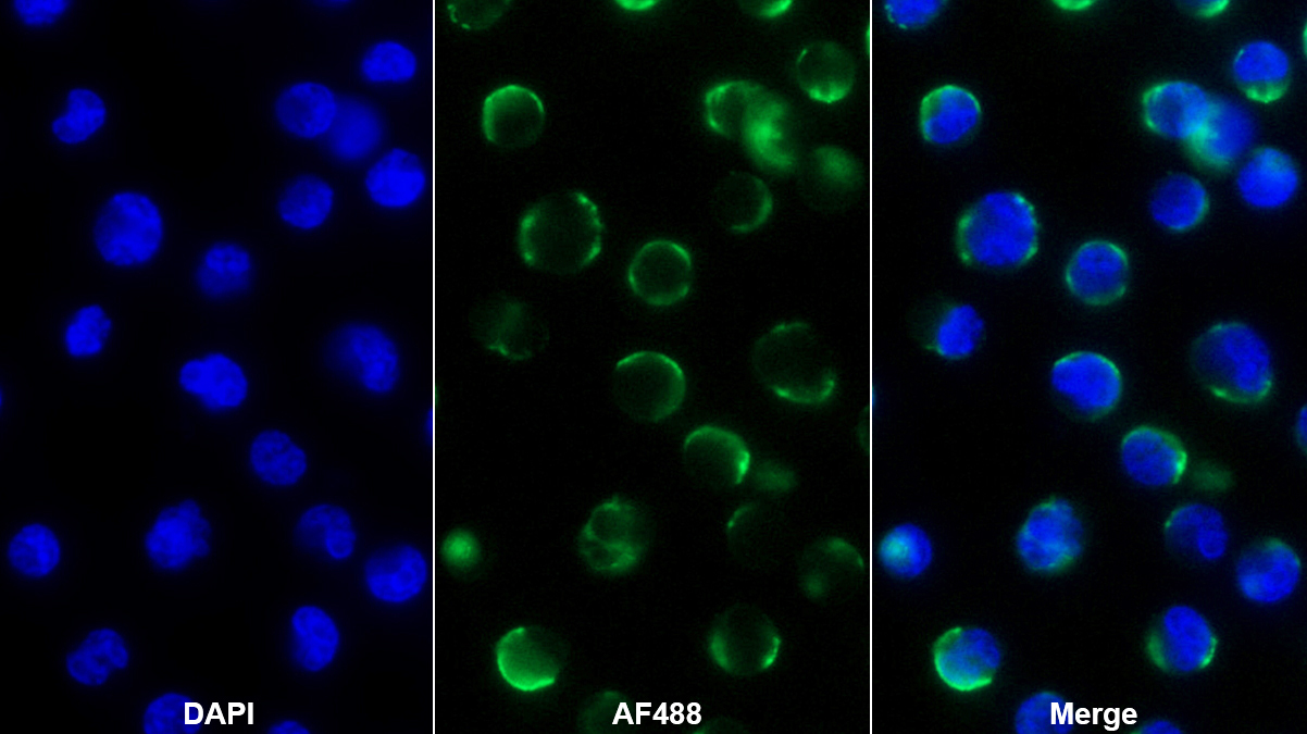 Monoclonal Antibody to Complement Receptor 2 (CD21)