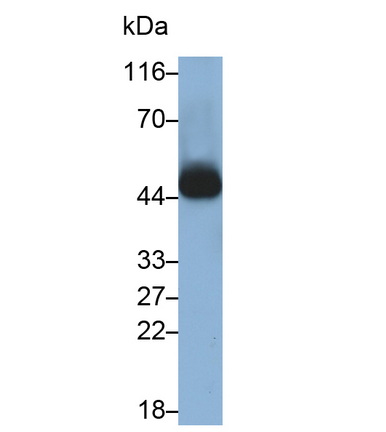 Monoclonal Antibody to Cluster Of Differentiation 38 (CD38)