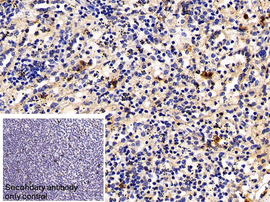 Monoclonal Antibody to Cluster Of Differentiation 38 (CD38)