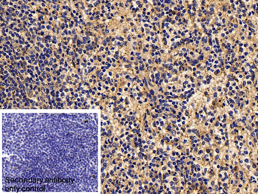 Monoclonal Antibody to Cluster Of Differentiation 38 (CD38)