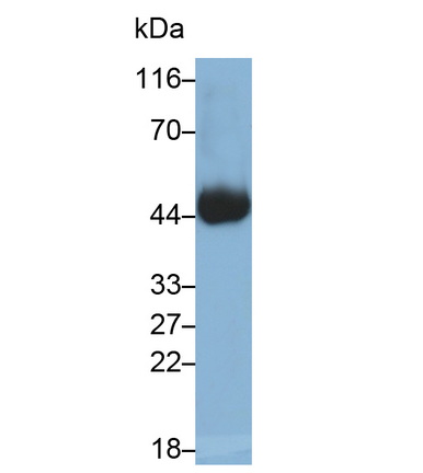 Monoclonal Antibody to Cluster Of Differentiation 38 (CD38)