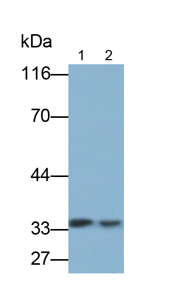Monoclonal Antibody to Cluster Of Differentiation 38 (CD38)
