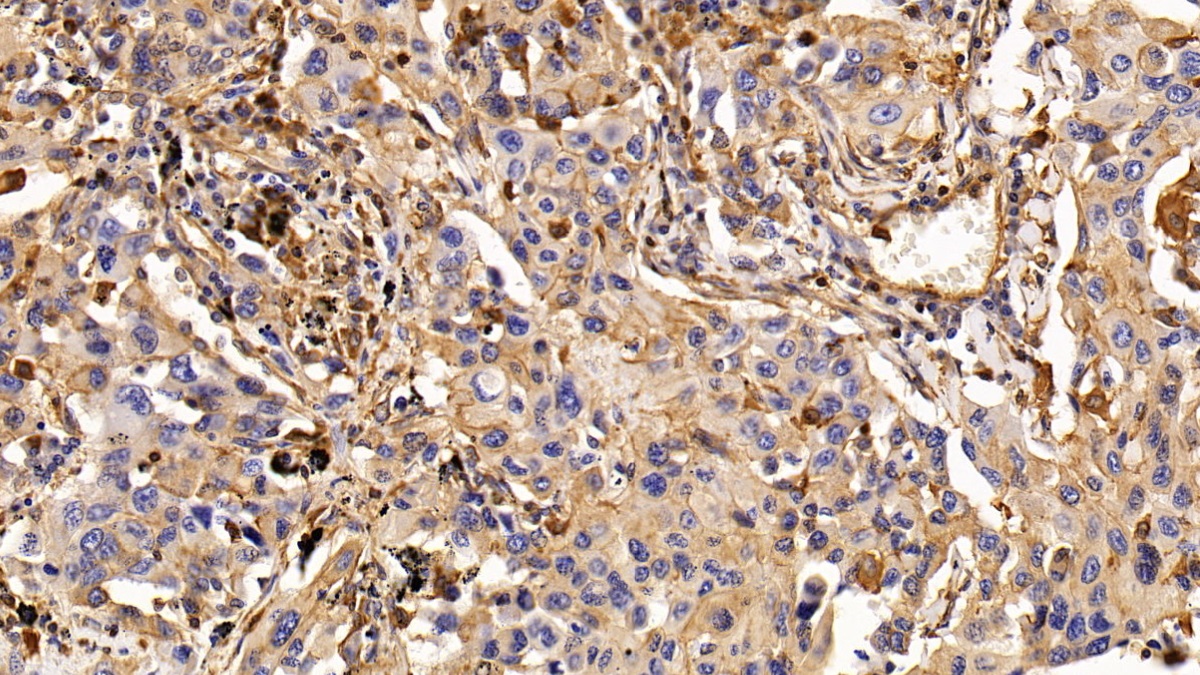 Monoclonal Antibody to Epidermal Growth Factor Receptor (EGFR)