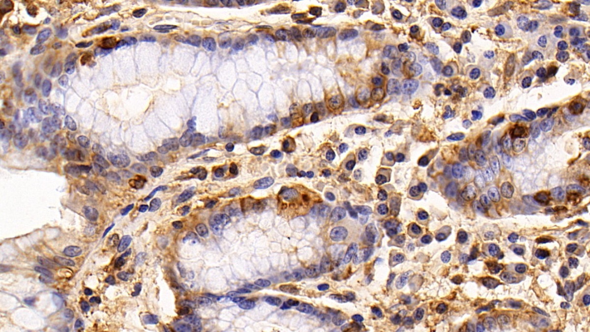 Monoclonal Antibody to Epidermal Growth Factor Receptor (EGFR)