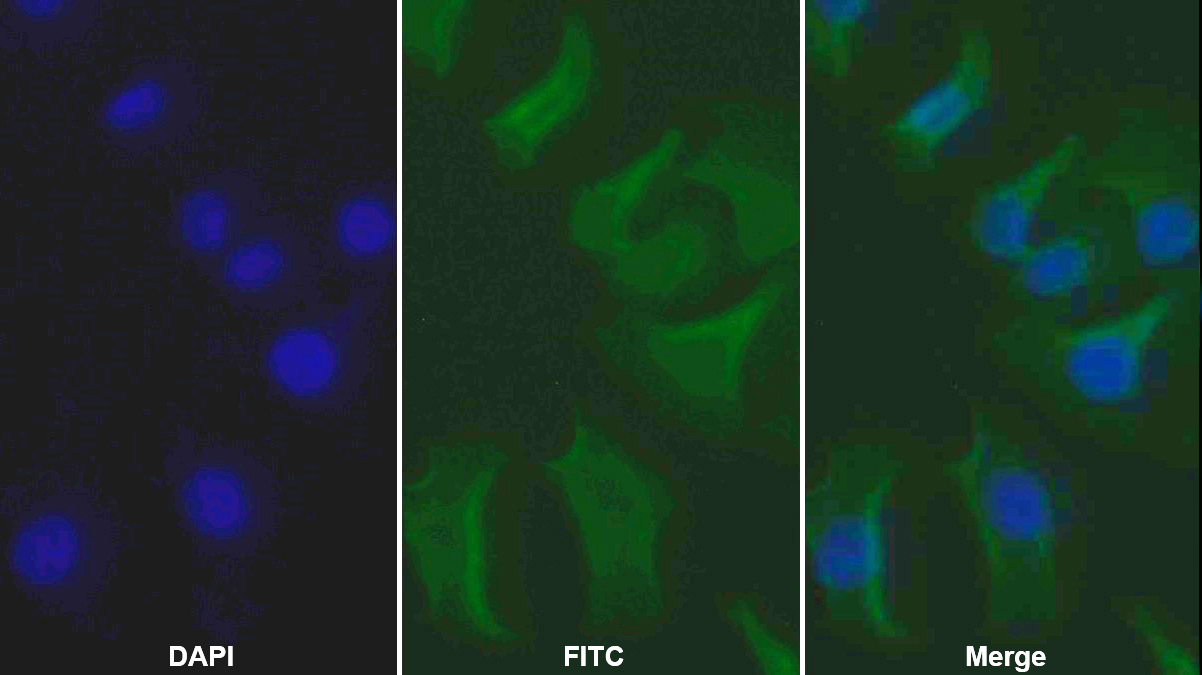Monoclonal Antibody to Epidermal Growth Factor Receptor (EGFR)