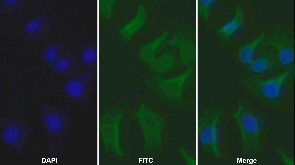 Monoclonal Antibody to Epidermal Growth Factor Receptor (EGFR)