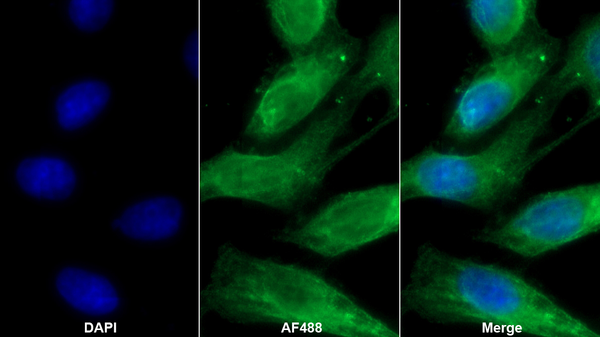 Monoclonal Antibody to Forkhead Box Protein O1 (FOXO1)