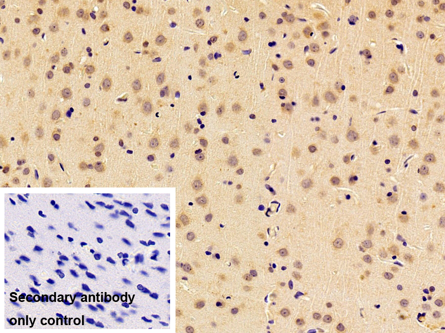 Monoclonal Antibody to Forkhead Box Protein O1 (FOXO1)