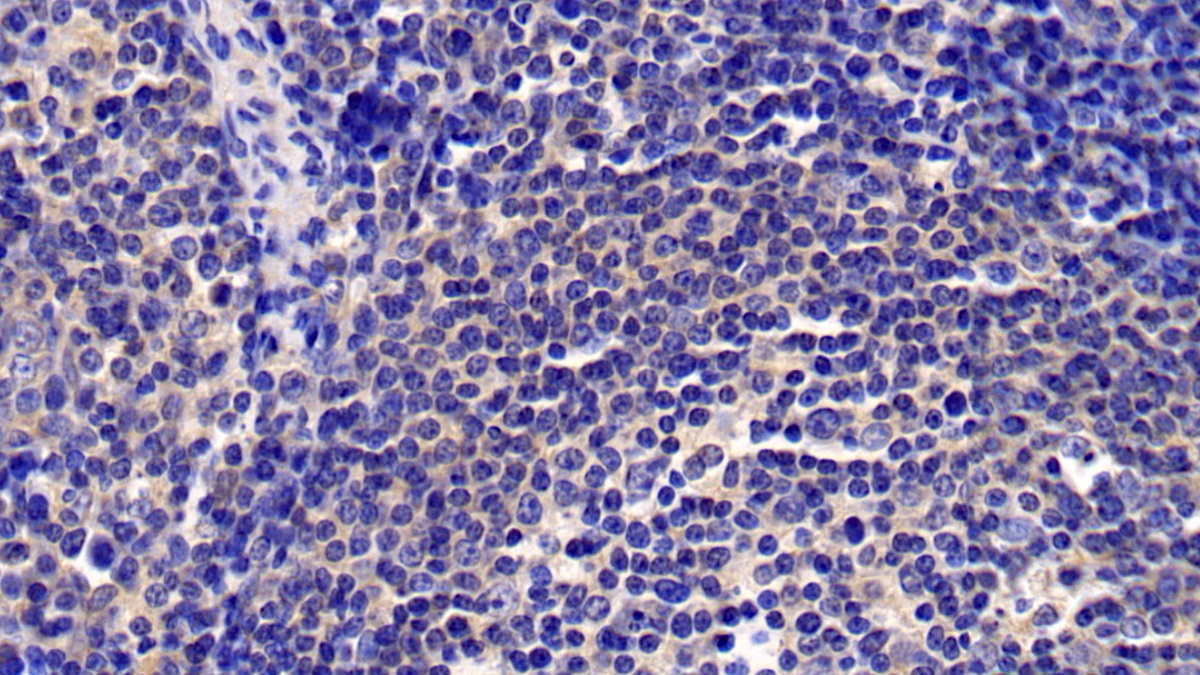 Monoclonal Antibody to Chemokine C-X-C-Motif Ligand 16 (CXCL16)