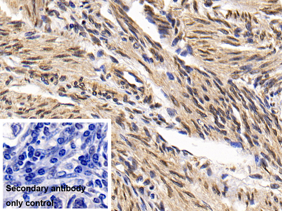 Monoclonal Antibody to B-Cell Leukemia/Lymphoma 2 (Bcl2)
