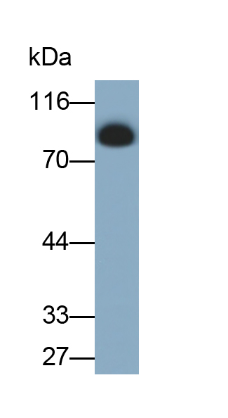 Monoclonal Antibody to Lactoferrin (LTF)