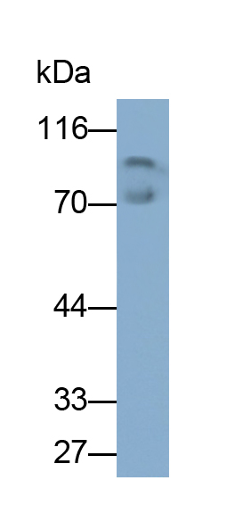 Monoclonal Antibody to Lactoferrin (LTF)