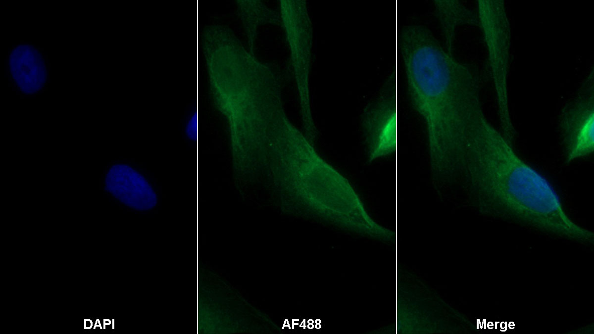 Monoclonal Antibody to Programmed Cell Death Protein 1 Ligand 2 (PDL2)