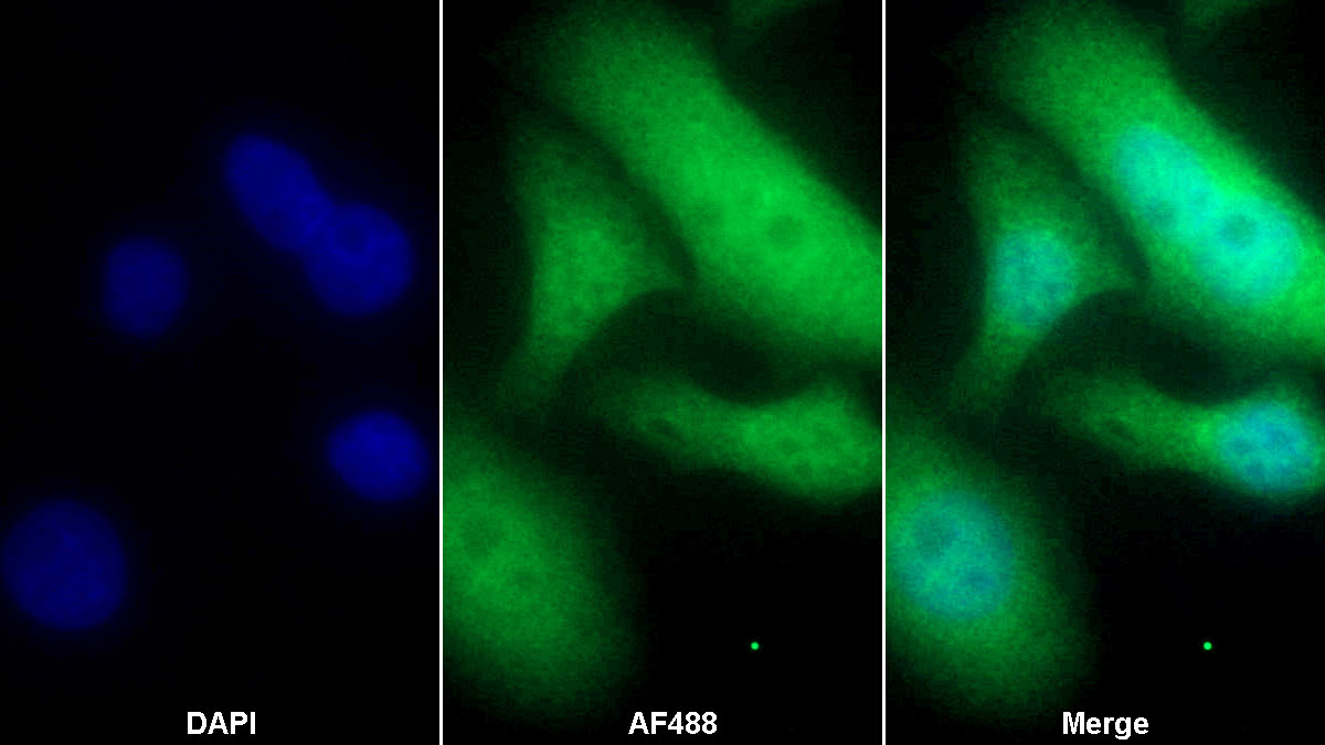 Monoclonal Antibody to Hypoxia Inducible Factor 1 Alpha (HIF1a)