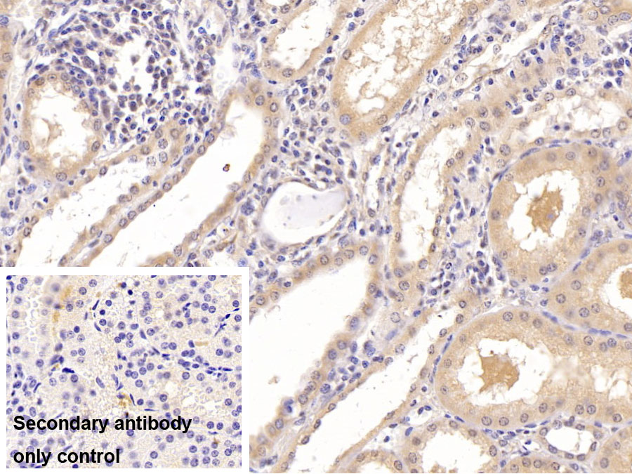 Monoclonal Antibody to Hypoxia Inducible Factor 1 Alpha (HIF1a)