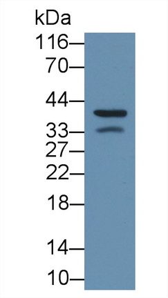 Monoclonal Antibody to Alpha-1-Acid Glycoprotein (a1AGP)