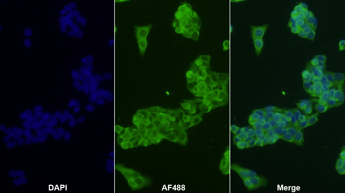 Monoclonal Antibody to Alpha-1-Acid Glycoprotein (a1AGP)