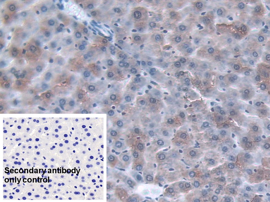 Monoclonal Antibody to Alpha-1-Acid Glycoprotein (a1AGP)