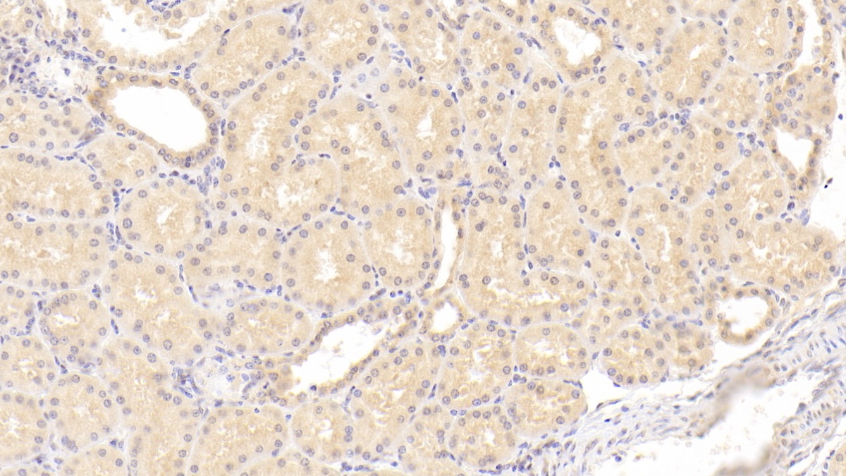 Monoclonal Antibody to Coagulation Factor II (F2)