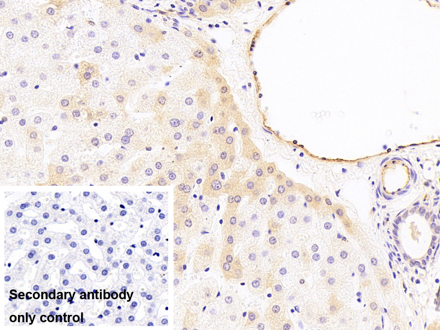 Monoclonal Antibody to Coagulation Factor II (F2)