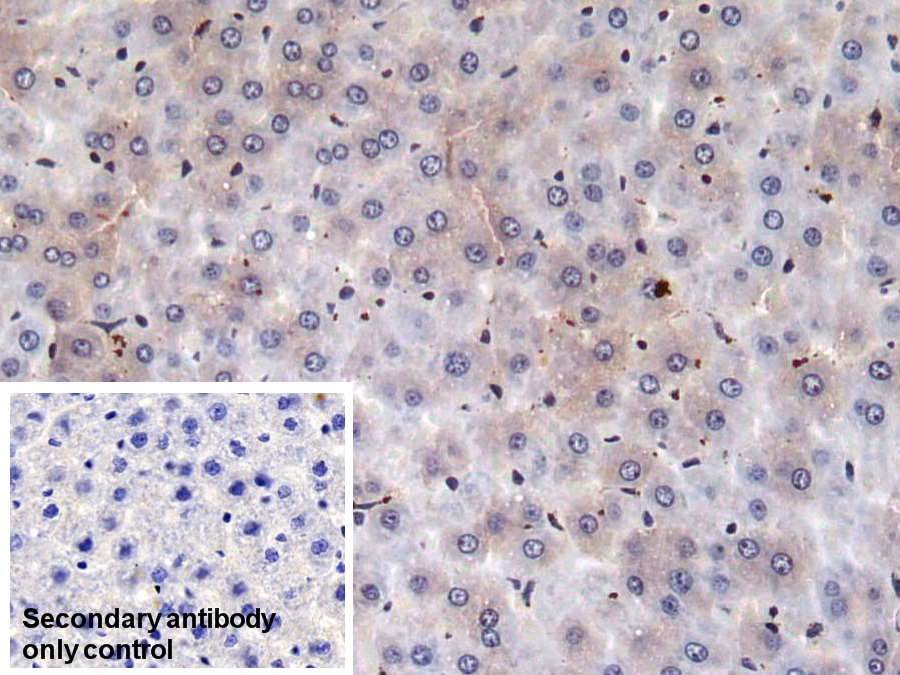 Monoclonal Antibody to Coagulation Factor II (F2)