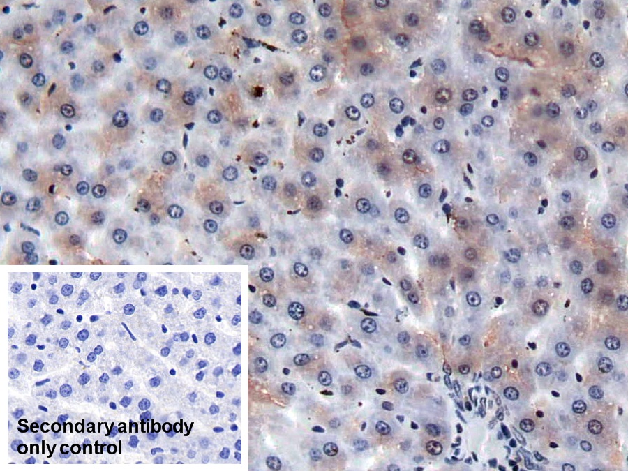 Monoclonal Antibody to Coagulation Factor II (F2)