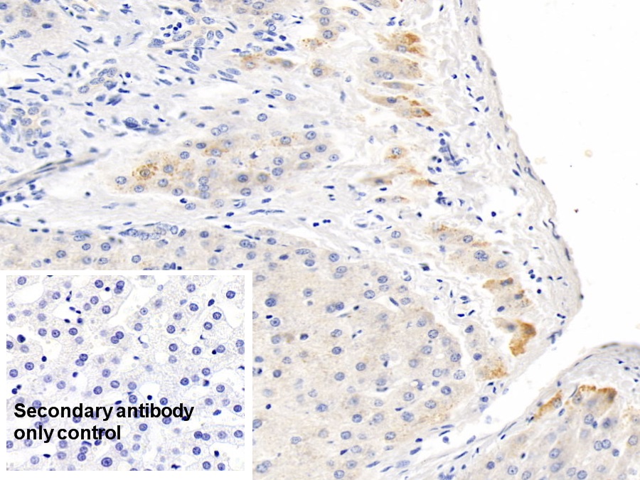 Monoclonal Antibody to C Reactive Protein (CRP)