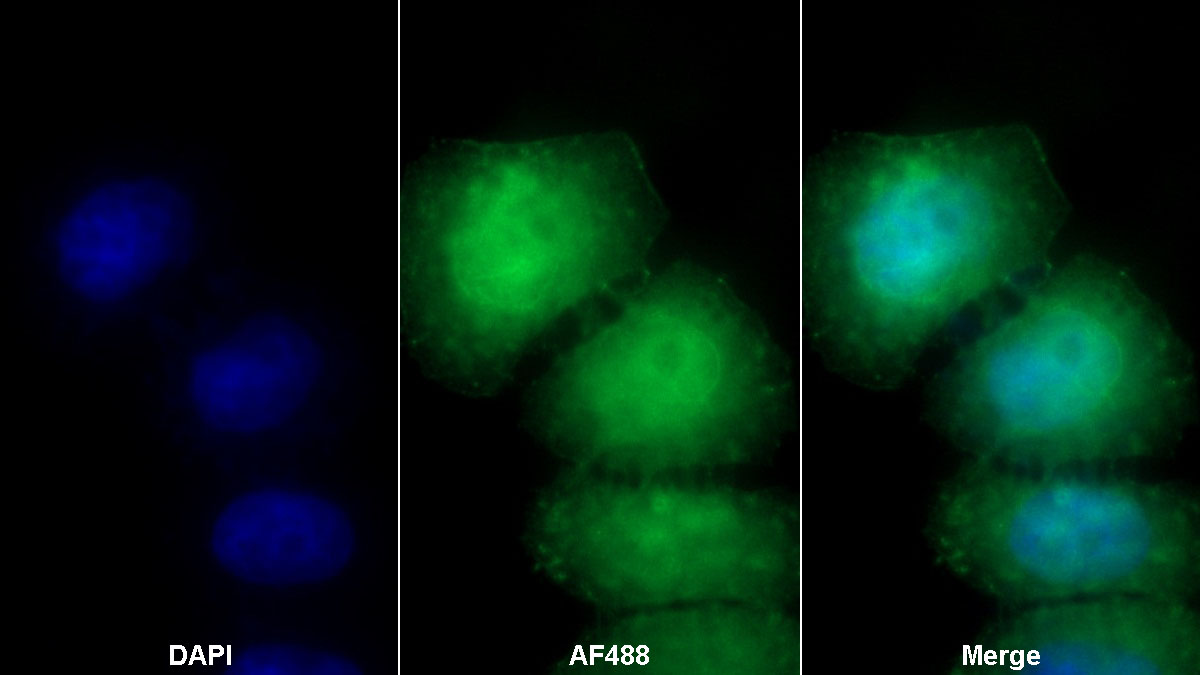 Monoclonal Antibody to Cluster Of Differentiation 86 (CD86)