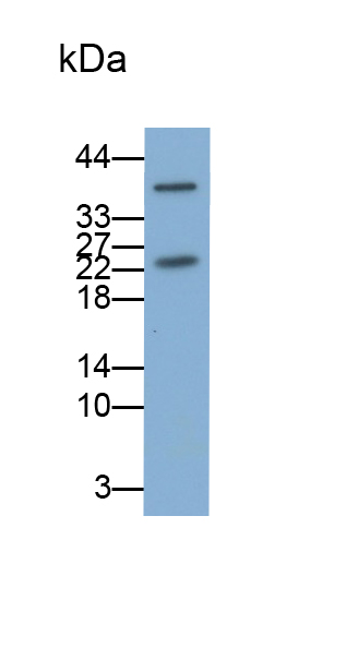 Monoclonal Antibody to Follicle Stimulating Hormone (FSH)