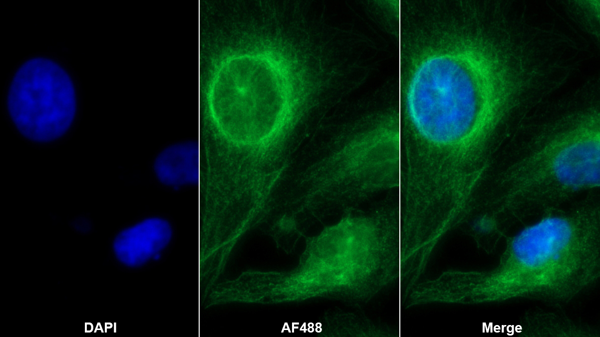 Monoclonal Antibody to Inhibin Beta A (INHbA)